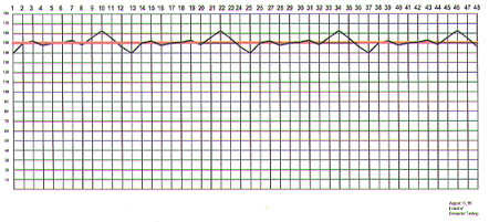 Exactrix Charts